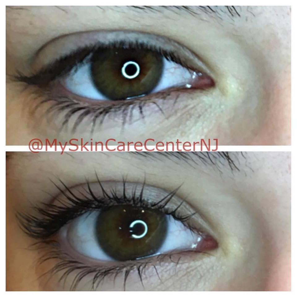 lash lift before & after